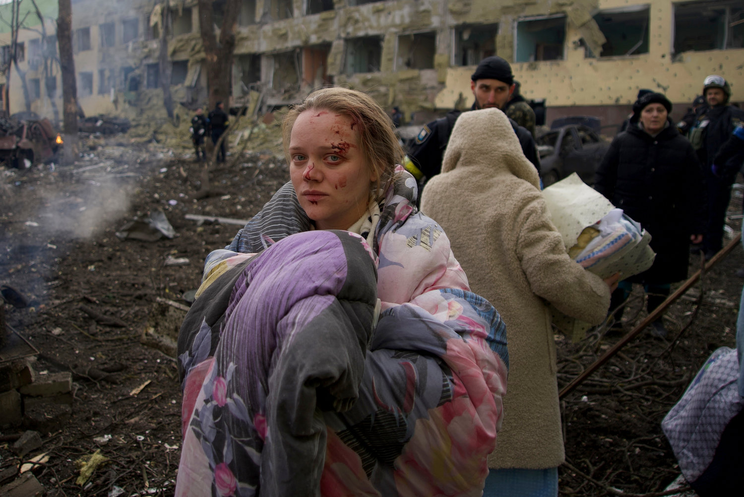 Mariana Vishegirskaya stands outside a maternity hospital that was damaged by shelling in Mariupol, Ukraine, Wednesday, March 9, 2022. Vishegirskaya survived the shelling and later gave birth to a girl in another hospital in Mariupol. (AP Photo / Mstyslav Chernov)
