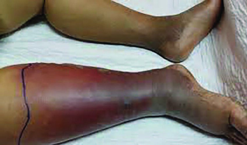 Inflammation and swelling are signs of deeper health issues.