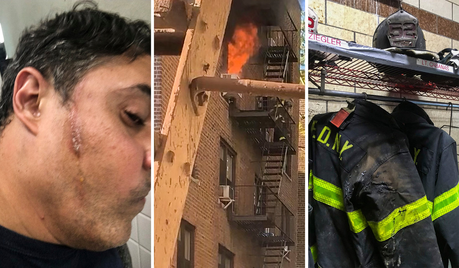 When Ladder 52 responded to a fire on the sixth floor of an apartment building on West 240th Street on Nov. 4, 2019, Lt. Gilbert Cabanas ran inside and saved a woman’s life. He suffered second-degree burns to his face and hands in the process, sending him to the hospital. As soon as he was discharged, he hugged his kids.