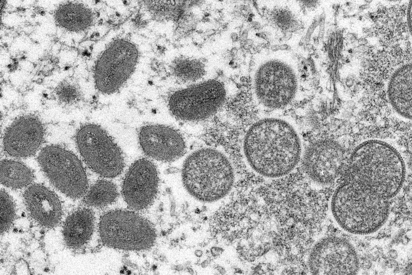 FILE - This 2003 electron microscope image made available by the Centers for Disease Control and Prevention shows mature, oval-shaped monkeypox virions, left, and spherical immature virions, right, obtained from a sample of human skin associated with the 2003 prairie dog outbreak. A leading doctor who chairs a World Health Organization expert group described the unprecedented outbreak of the rare disease monkeypox in developed countries as &quot;a random event&quot; that might be explained by risky sexual behavior at two recent mass events in Europe.