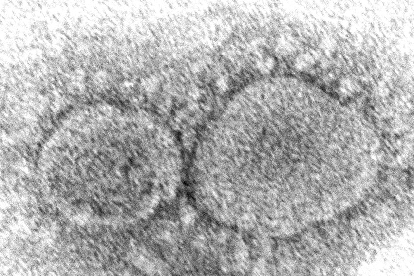 This 2020 electron microscope image made available by the Centers for Disease Control and Prevention shows SARS-CoV-2 virus particles, which cause COVID-19. A crucial question has eluded governments and health agencies since the COVID-19 pandemic began: Did the virus originate in animals or leak from a Chinese lab? Now, the U.S. Department of Energy has assessed with &ldquo;low confidence&rdquo; that it began with a lab leak although others in the U.S. intelligence community disagree.