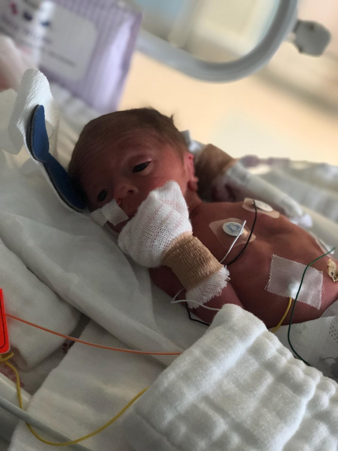 GETTING TREATMENT — Sloane Rose Hurlbut rests in the hospital following her premature birth in early 2019. She is now a healthy, happy toddler.