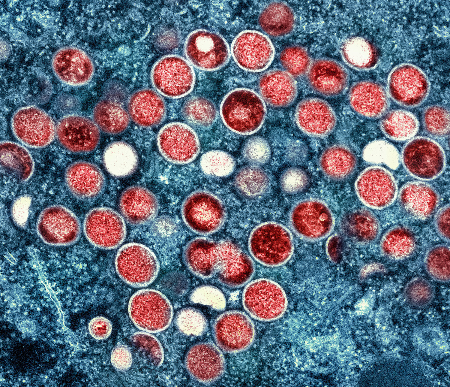 This image provided by the National Institute of Allergy and Infectious Diseases (NIAID) shows a colorized transmission electron micrograph of monkeypox particles (red) found within an infected cell (blue), cultured in the laboratory that was captured and color-enhanced at the NIAID Integrated Research Facility (IRF) in Fort Detrick, Md. The World Health Organization has renamed monkeypox as mpox, citing concerns the original name of the decades-old animal disease could be construed as discriminatory and racist.